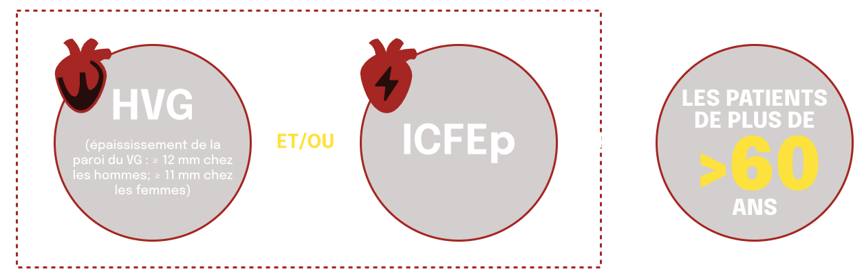LVH and HFpEF Key Red Flags Of ATTR CM