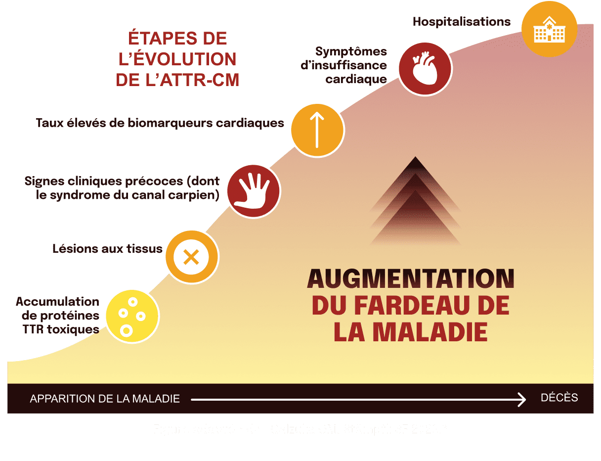 Évolution de la CM-ATTR