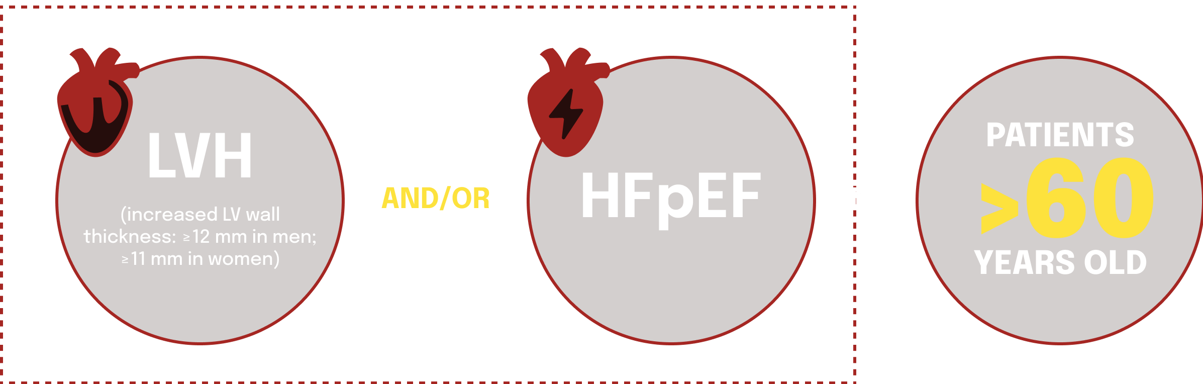 LVH and HFpEF Key Red Flags Of ATTR CM