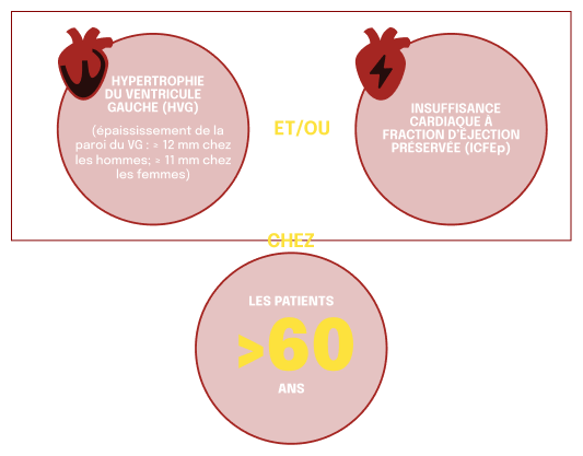 LVH and HFpEF Key Red Flags Of ATTR-CM