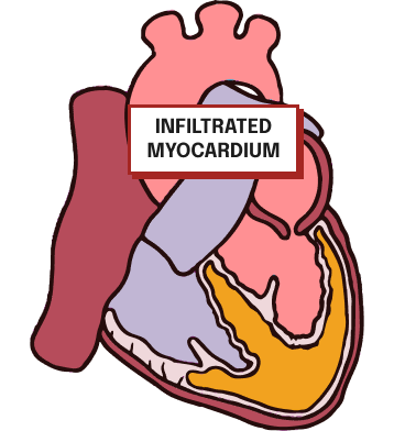 mobile-heart-fr-image