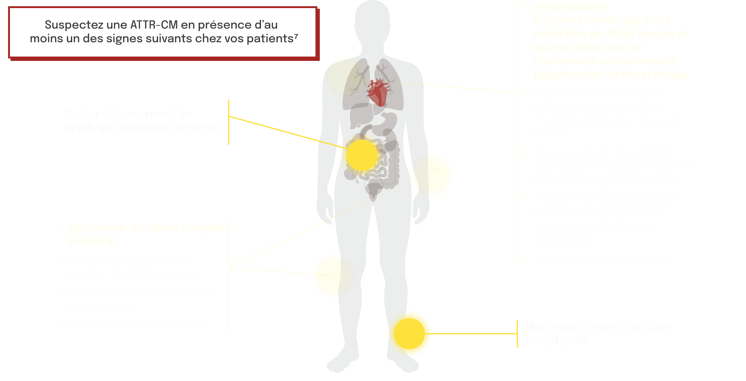 Schéma de l'atteinte cardiaque liée à l'ATTR-CM